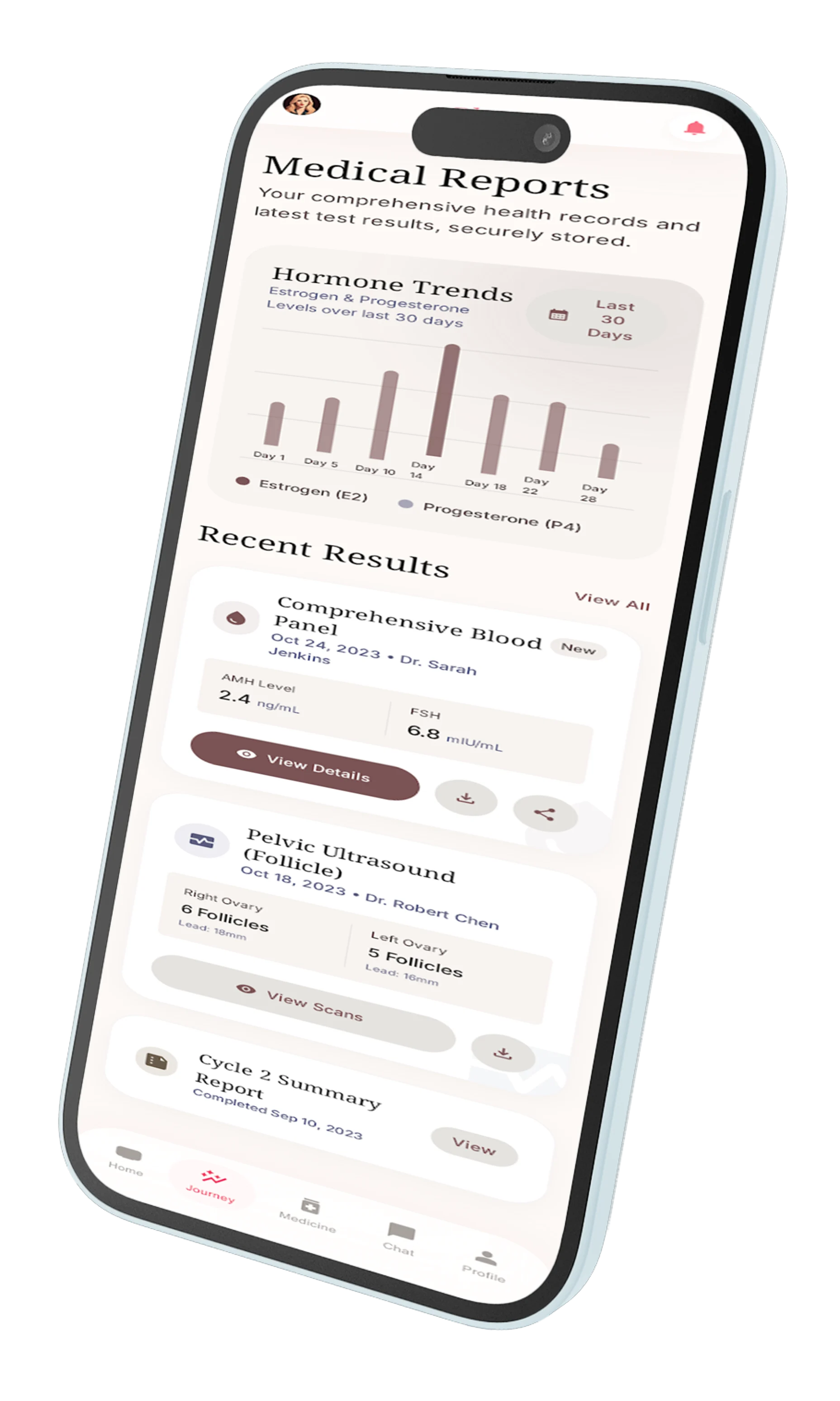 IVF App Screenshot 3